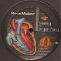 Pacemaker 01