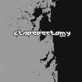 Stapedectomy 01